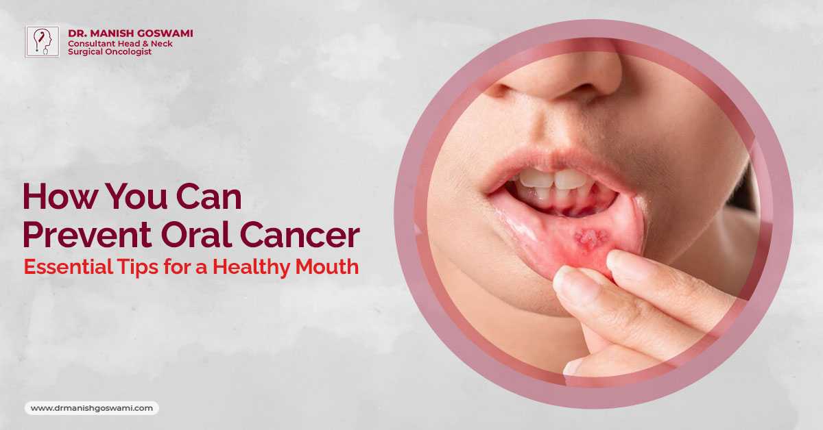 How You Can Prevent Oral Cancer: Essential Tips for a Healthy Mouth