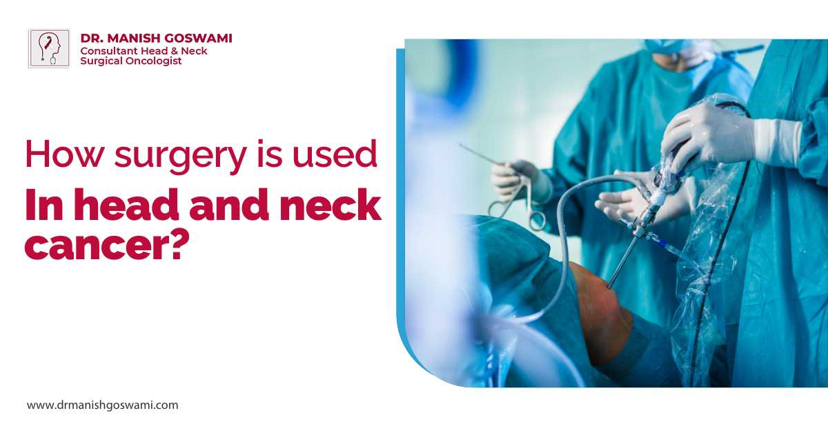 How Surgery is Used in Head and Neck Cancer?