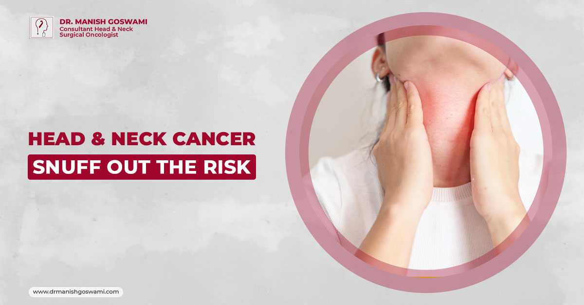 Head & Neck Cancer: Snuff Out the Risk