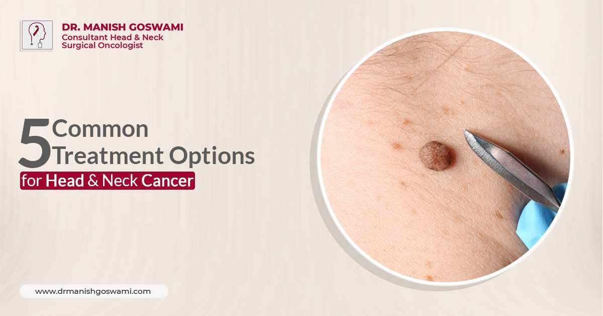 Head & Neck Oncologist in Siliguri