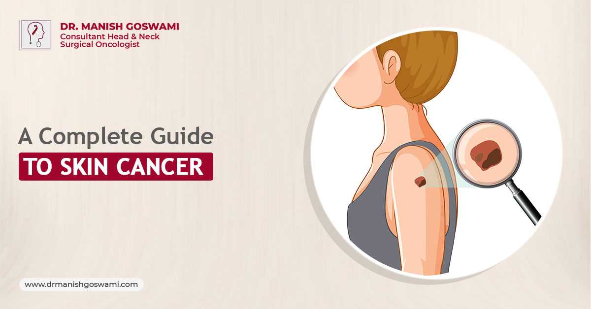 A Complete Guide to Skin Cancer