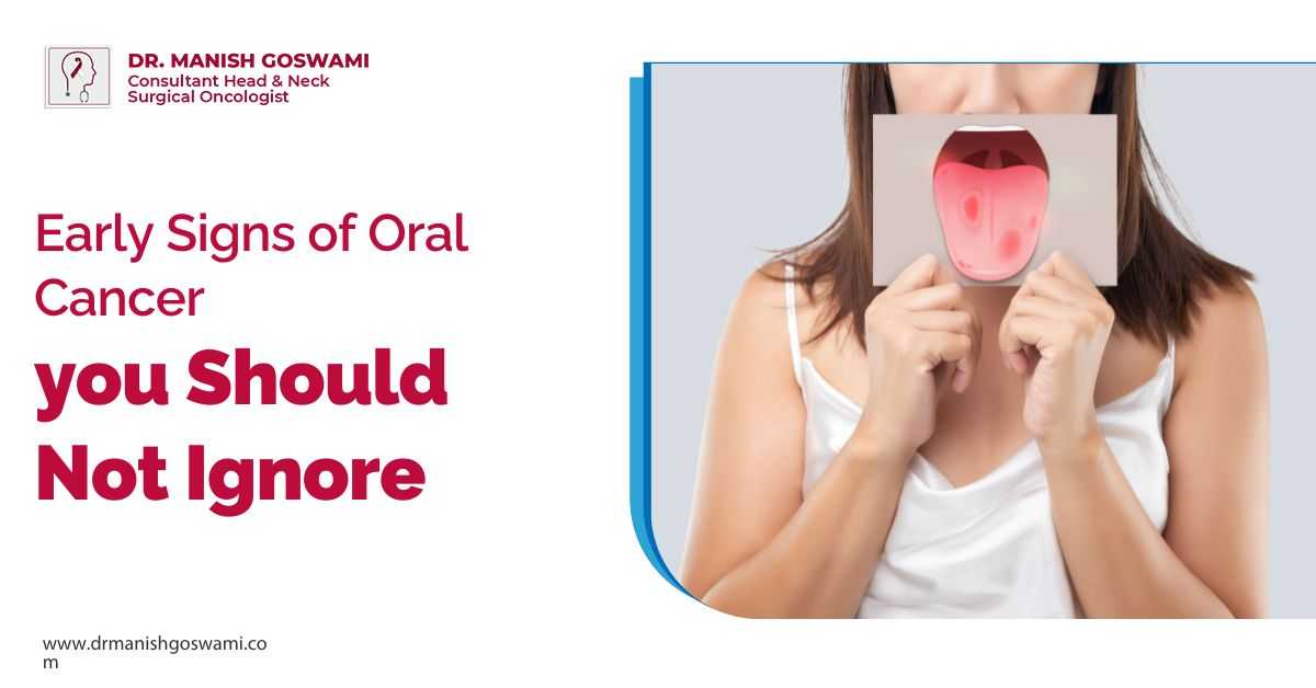 Early Signs of Oral Cancer You Should Not Ignore