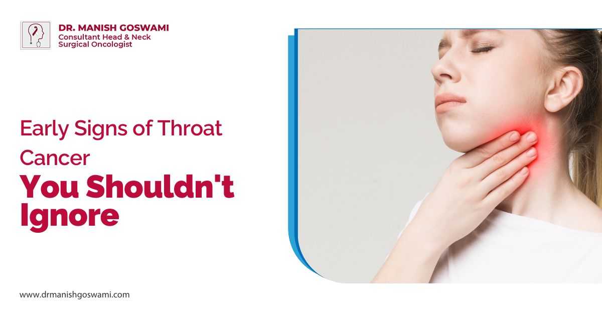 Early Signs of Throat Cancer You Shouldn't Ignore