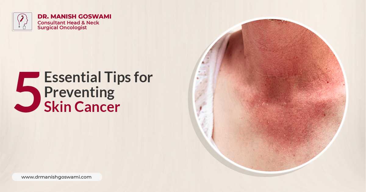 Cancer Doctor in Siliguri