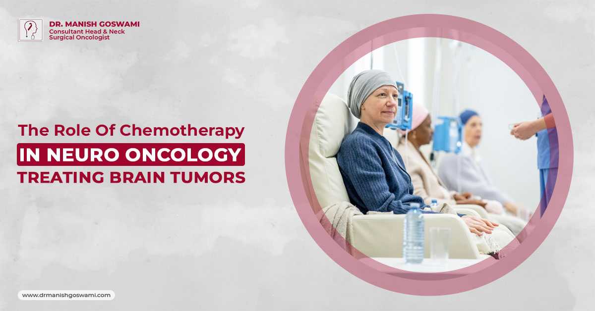 The Role of Chemotherapy in Neuro-Oncology: Treating Brain Tumors