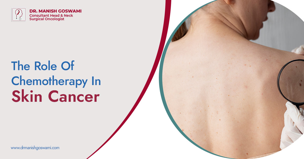 The Role of Chemotherapy in Skin Cancer