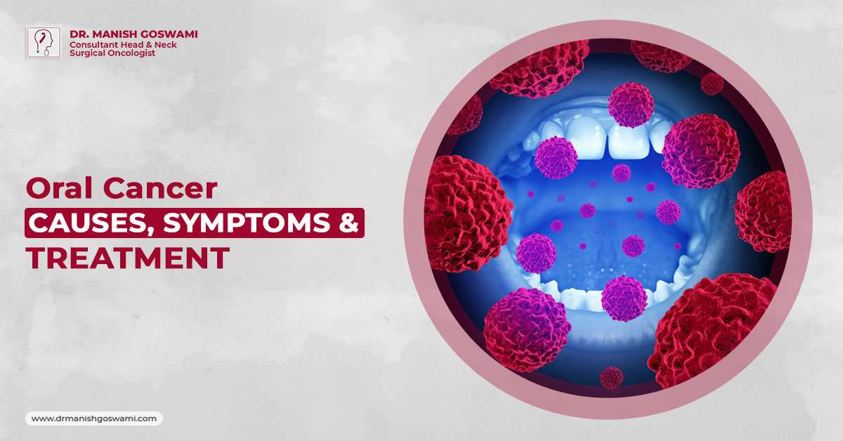 Oral Cancer: Causes, Symptoms & Treatment
