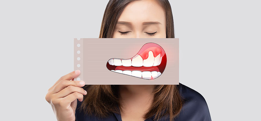 Oral Cancer Siliguri