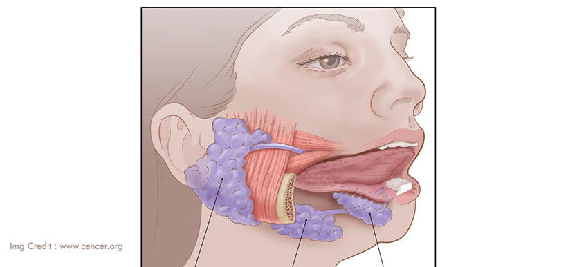 Salivary Gland Cancer