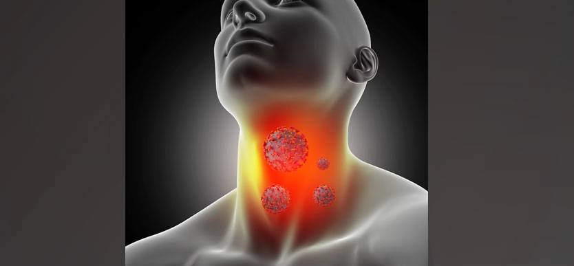 Throat Cancer