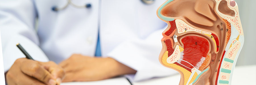 Nasopharyngeal cancer