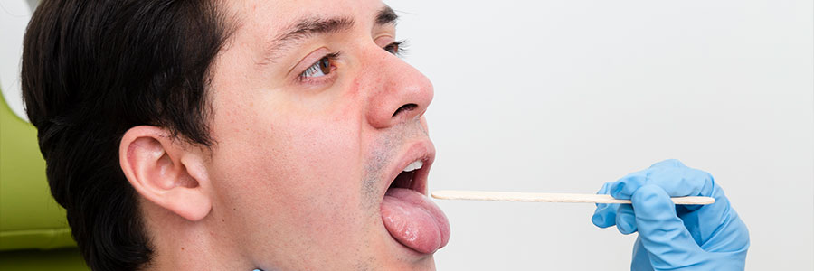 Salivary Gland Cancer